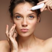 skincare for acne