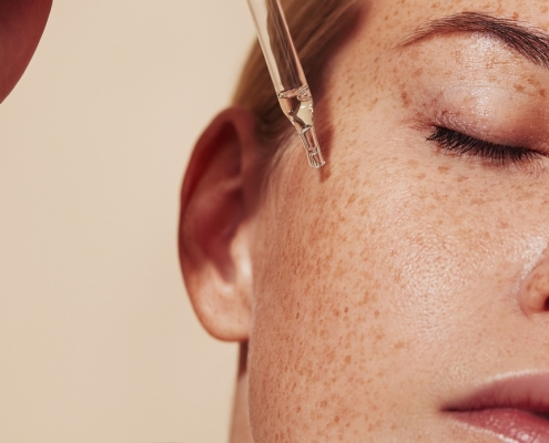 Close-up,Highly,Detailed,Shot,Of,Female,Skin,With,Freckles, retinol