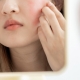 woman asian are worried about faces Dermatology and allergic to steroids in cosmetics. sensitive skin, red face from sunburn, acne, allergic to chemicals, rash on face. skin problems and beauty