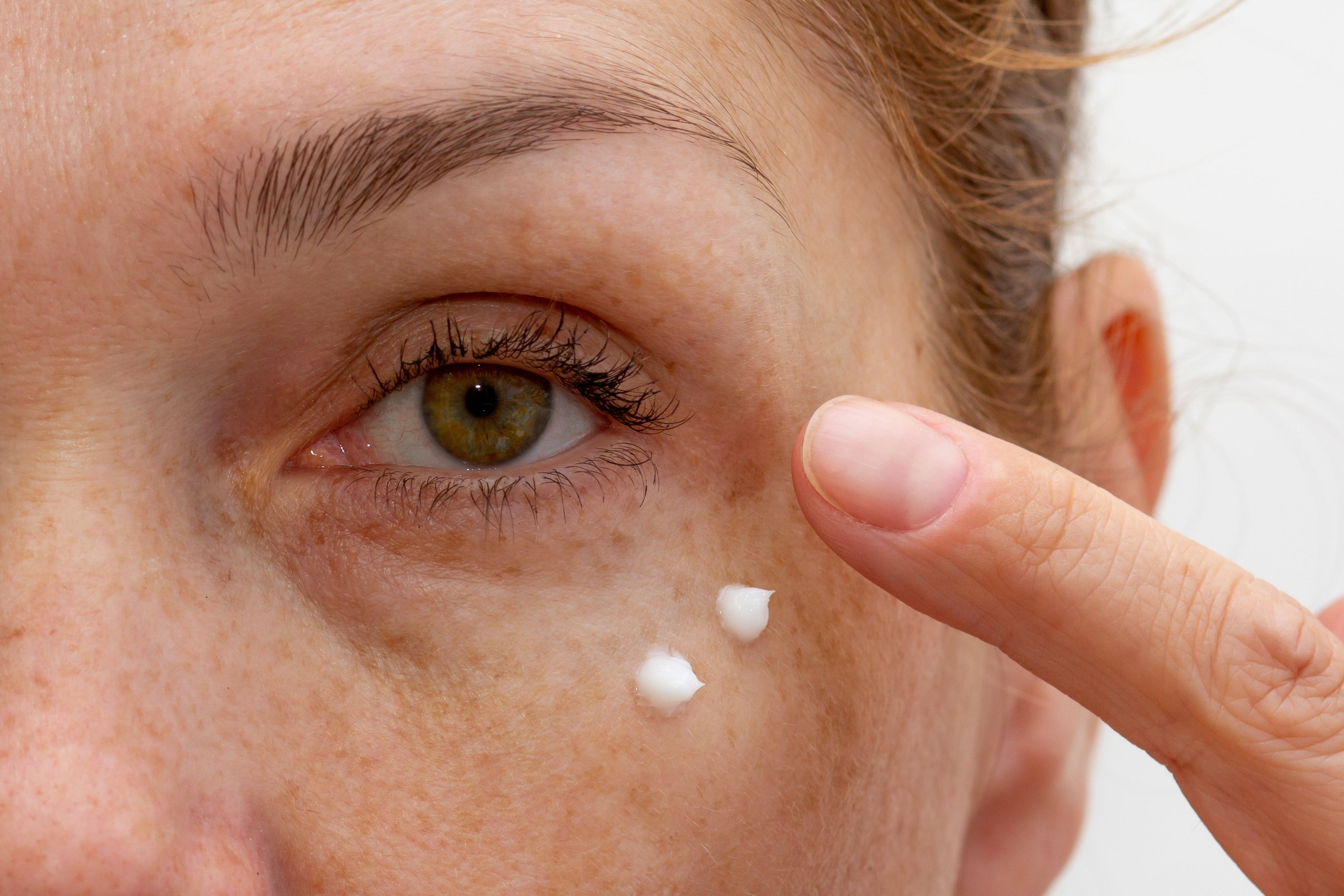 Dark circles and puffy eyes? These are the best solutions