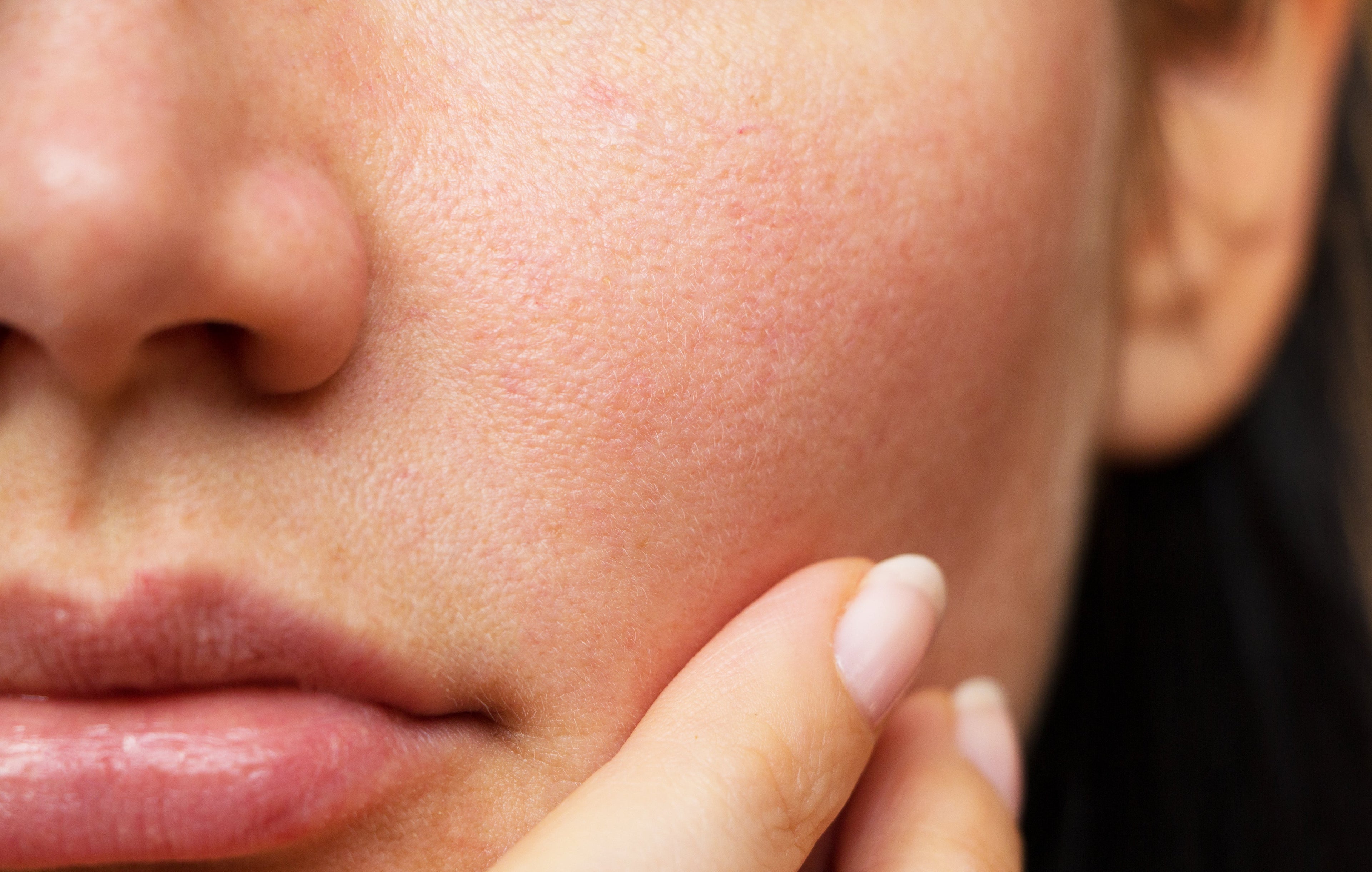 Expert approved: The best skincare products for sensitive skin