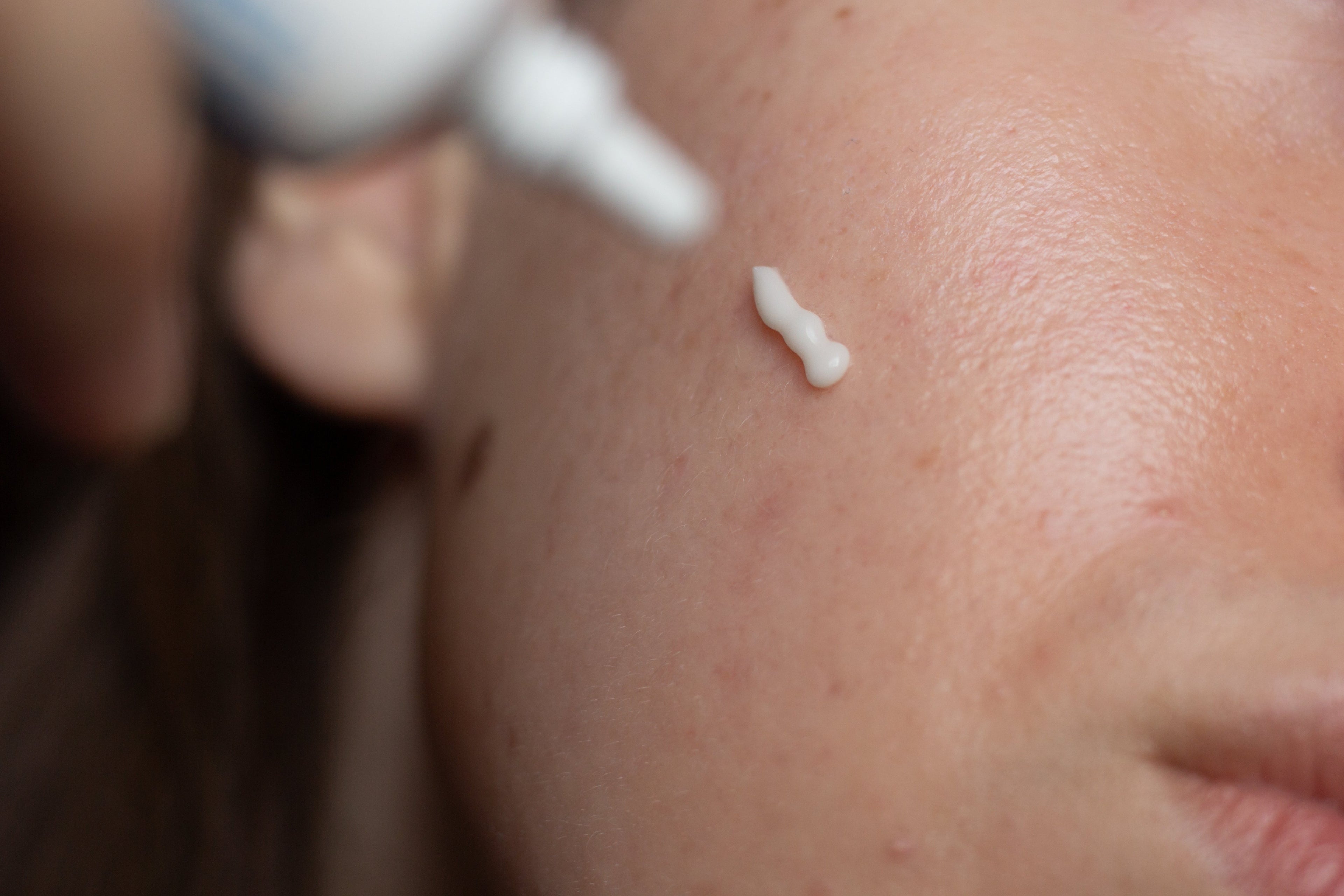 Fine lines, wrinkles and dark spots? Here’s how retinol can help