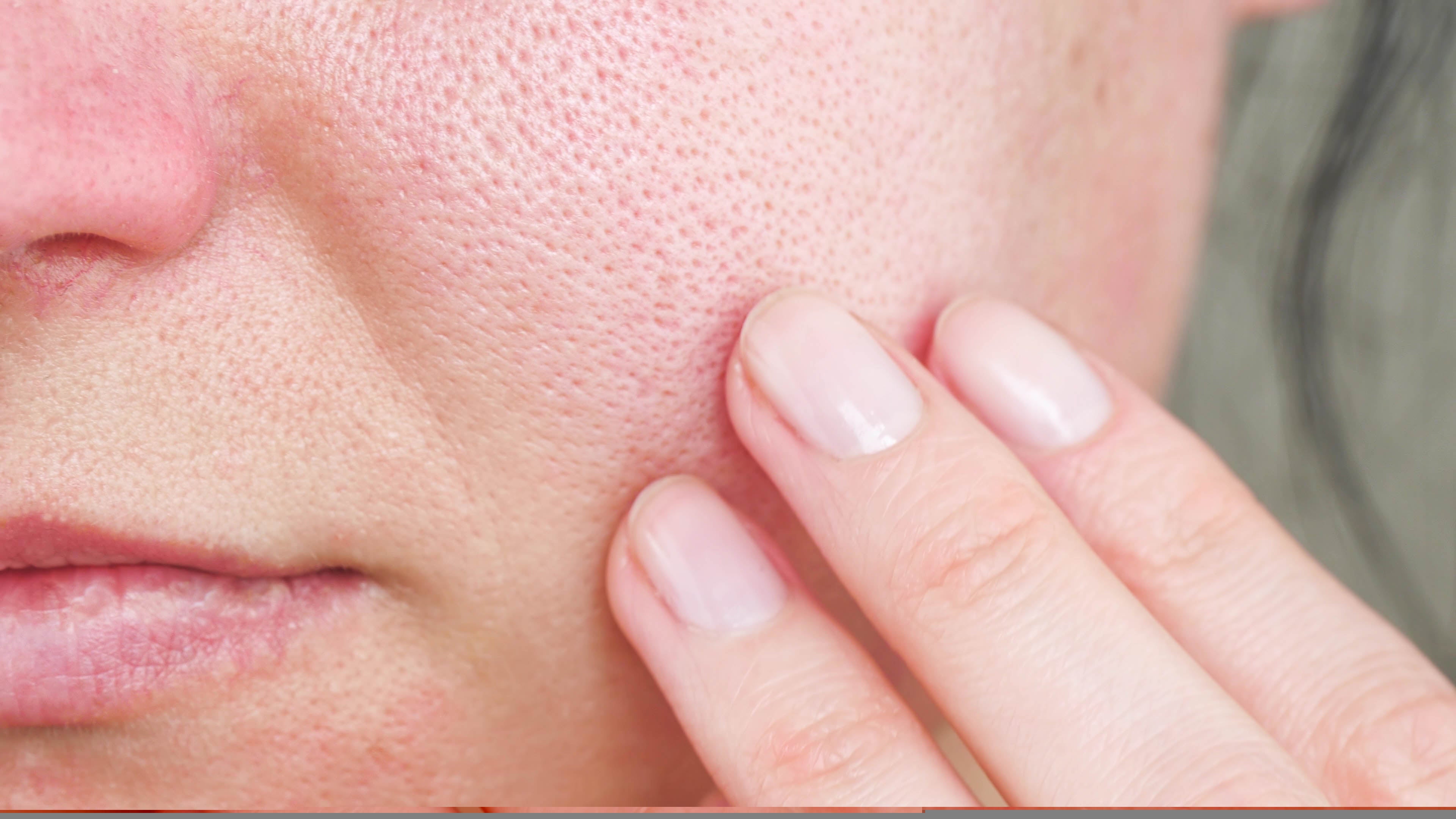 How to make your pores look smaller in 7 simple steps