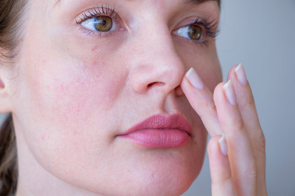Rosacea skin? The best products to calm facial flare-ups