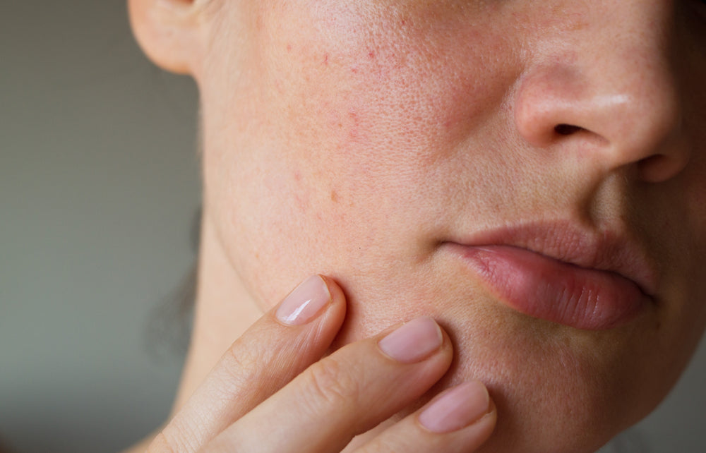 Beauty Collective - Exfoliation and Sensitive Skin