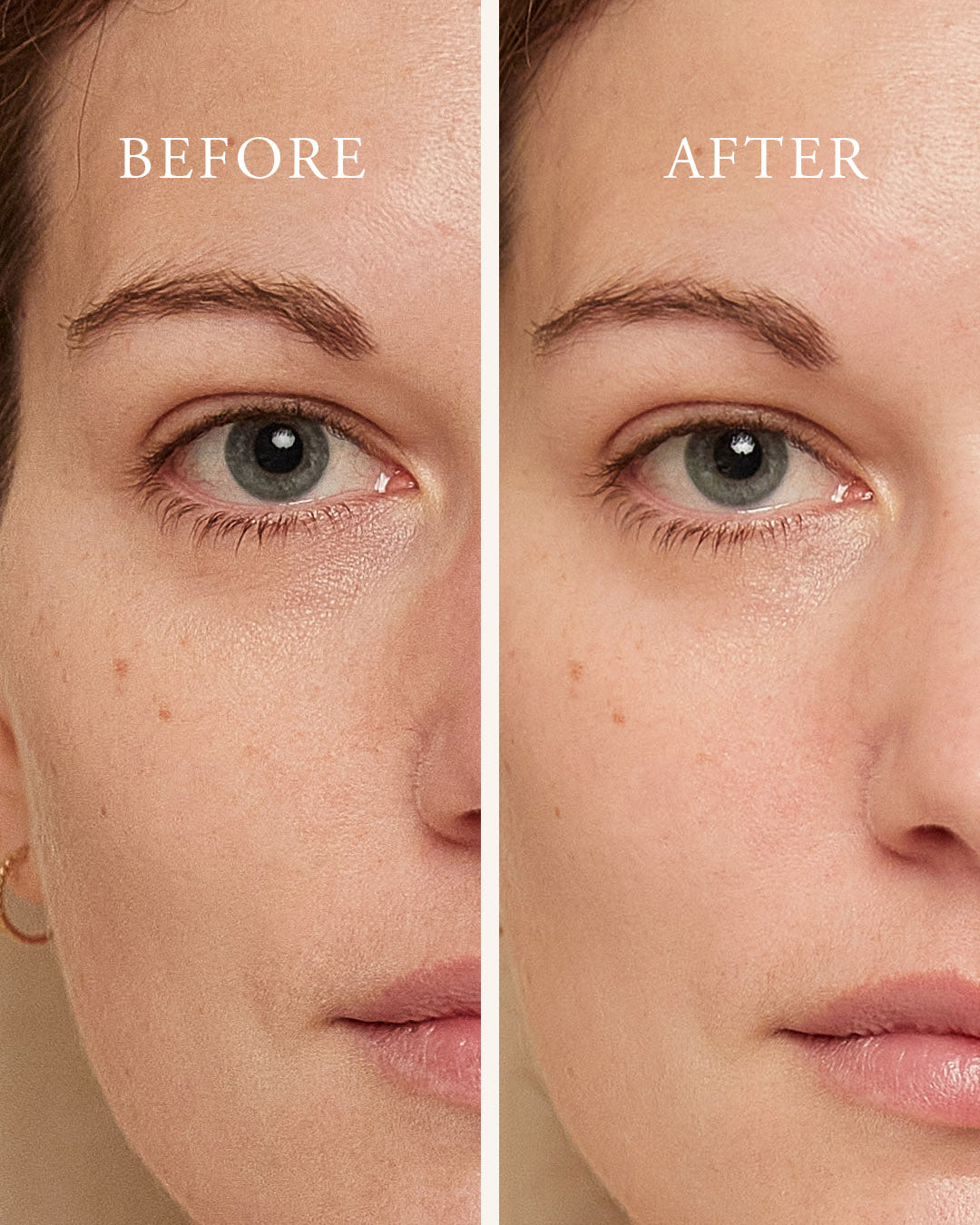 Before and After use of Phytomer Eye Flash Smoothing Reviving Mask 