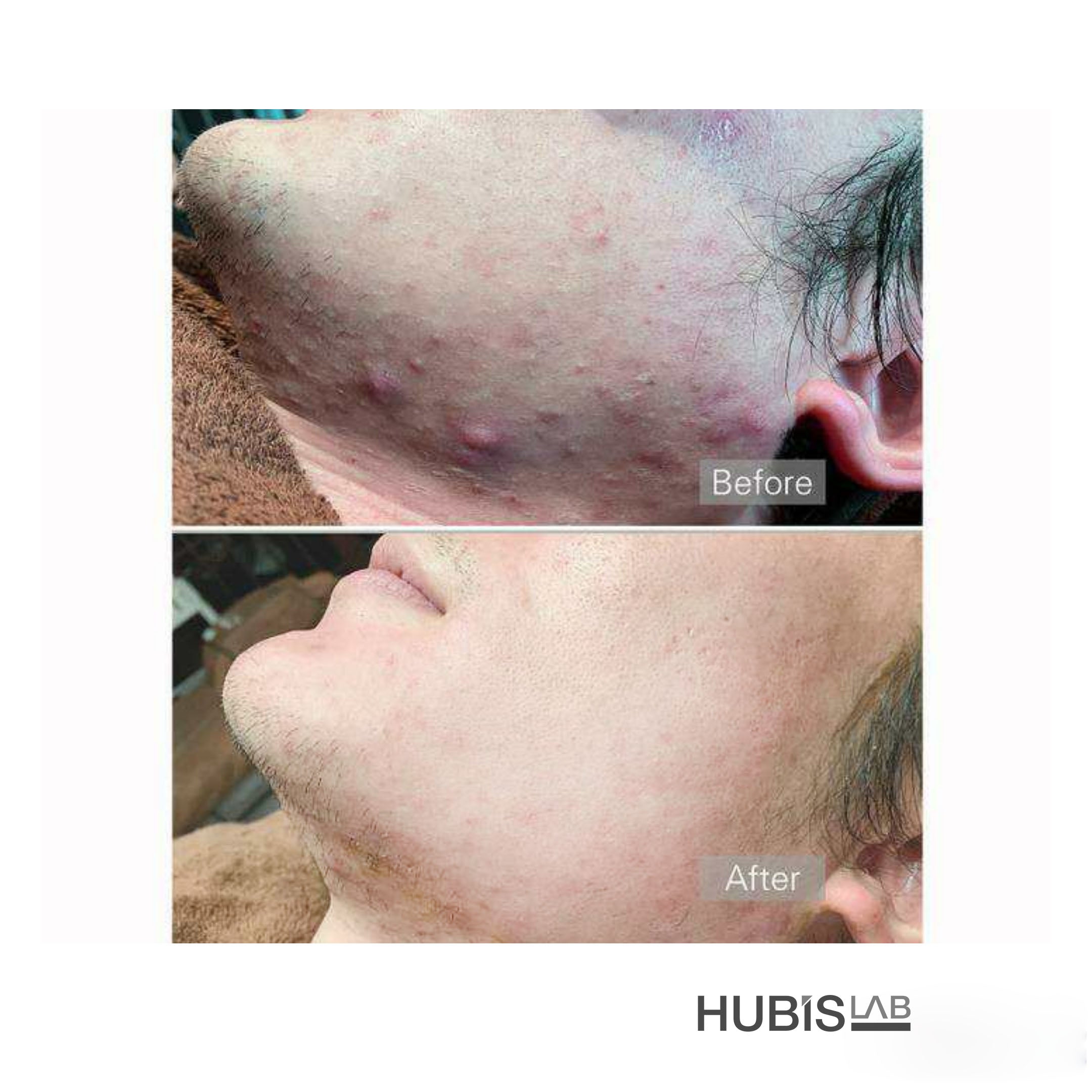 Hubislab A.C. Clearing Line Gift Set