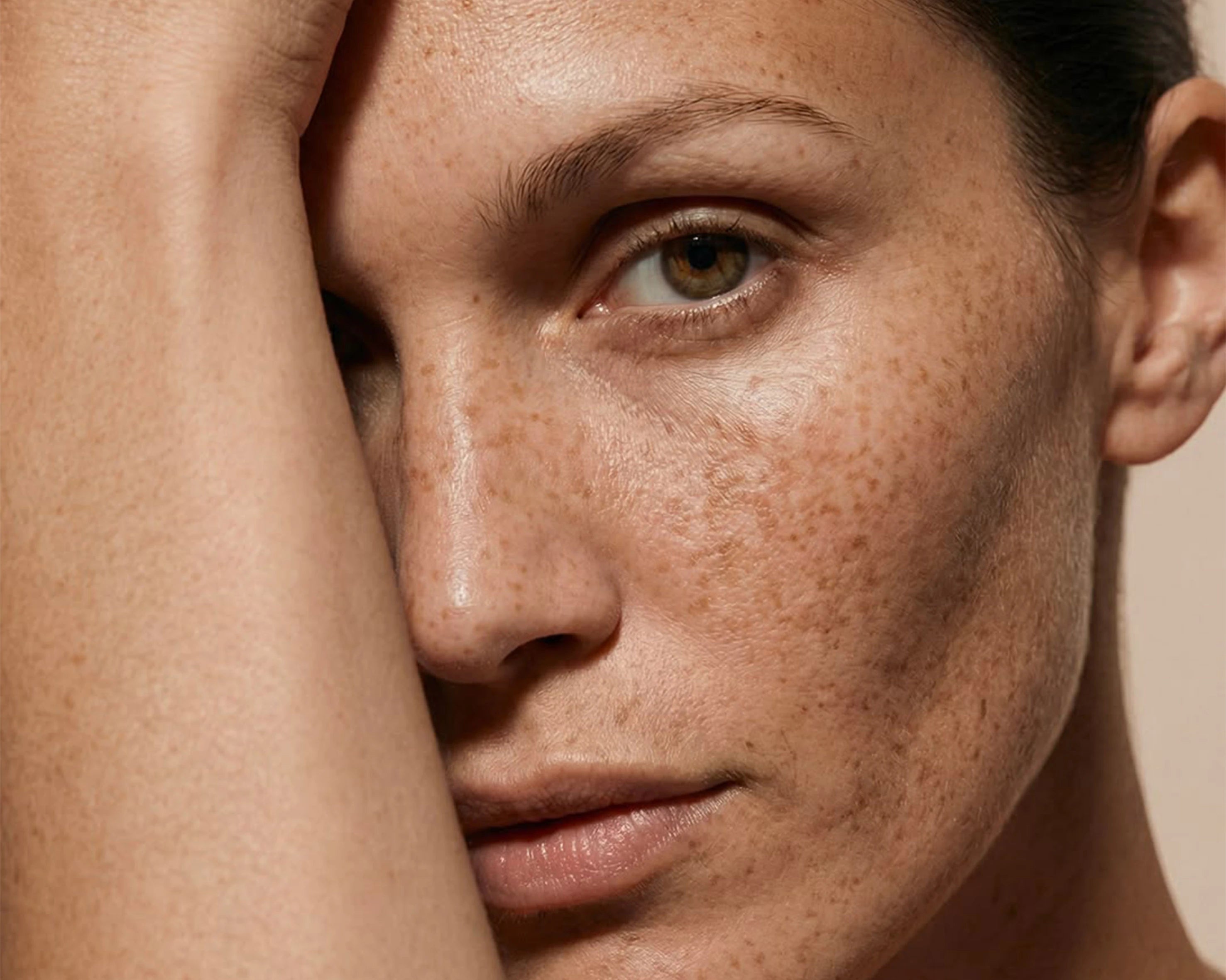 pigmentation and dark spots concern